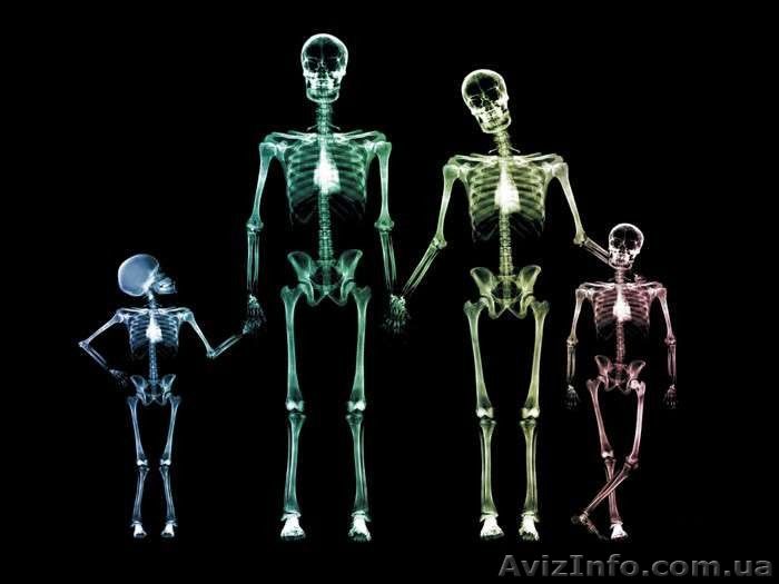 Куплю рентген снимки, фиксаж, кинопленку! - <ro>Изображение</ro><ru>Изображение</ru> #1, <ru>Объявление</ru> #1156183