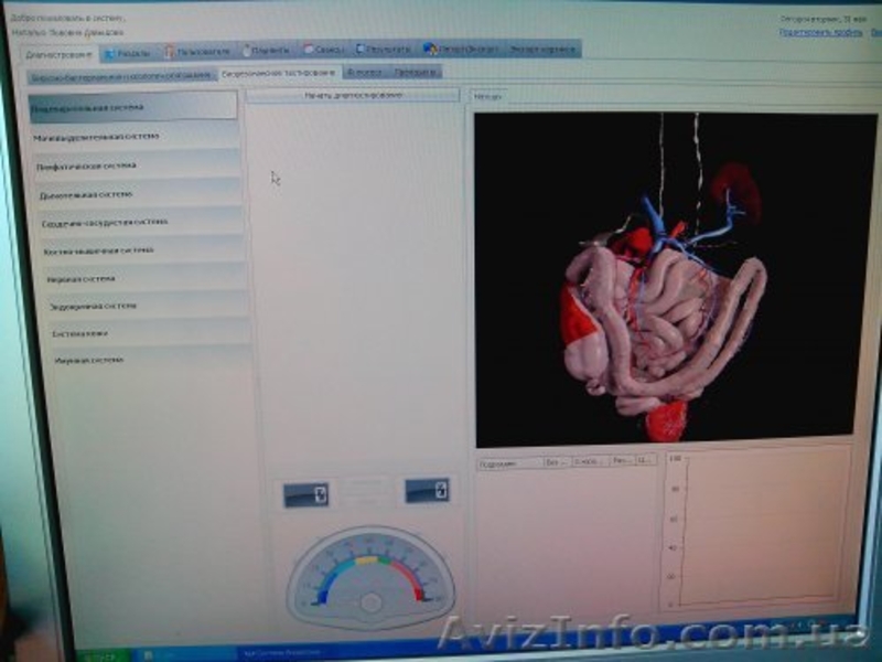 Копьютерная диагностика Паркес - <ro>Изображение</ro><ru>Изображение</ru> #3, <ru>Объявление</ru> #1450719